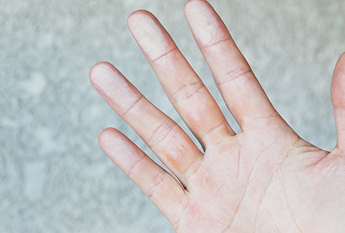 壁を触ると粉がつく